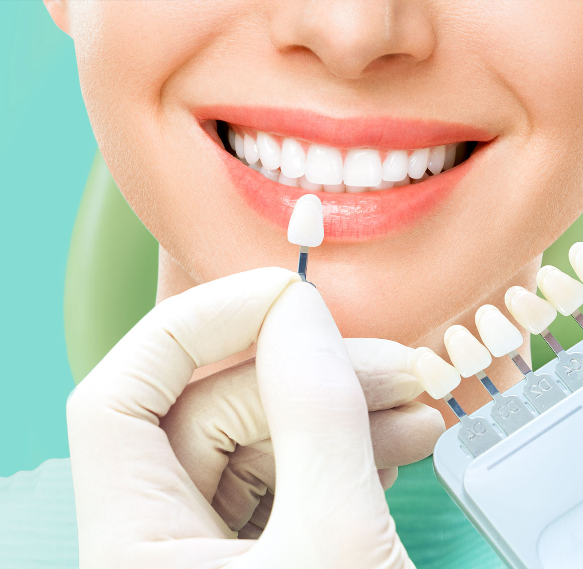 teeth-whitening